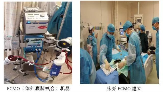 心肺的最早情况，探寻人体健康的起点之路